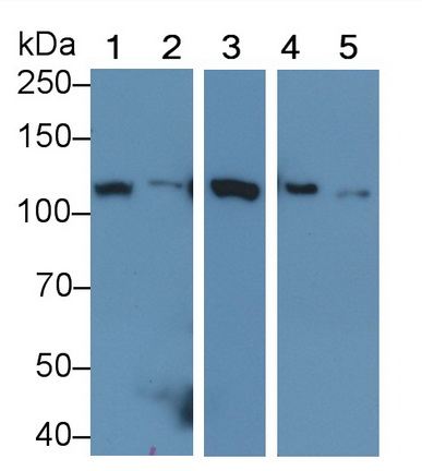 Monoclonal Antibody to Hexokinase 1 (HK1)