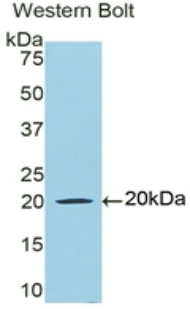 Monoclonal Antibody to Lactoferrin (LTF)