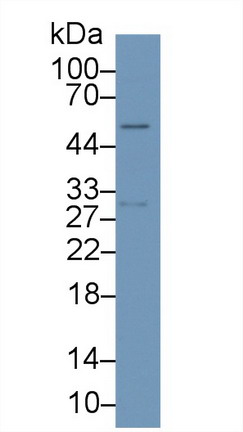 Monoclonal Antibody to Programmed Cell Death Protein 1 Ligand 1 (PDL1)