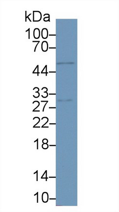 Monoclonal Antibody to Programmed Cell Death Protein 1 Ligand 1 (PDL1)