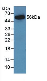 Monoclonal Antibody to Angiotensinogen (AGT)