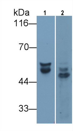 Monoclonal Antibody to Angiotensinogen (AGT)