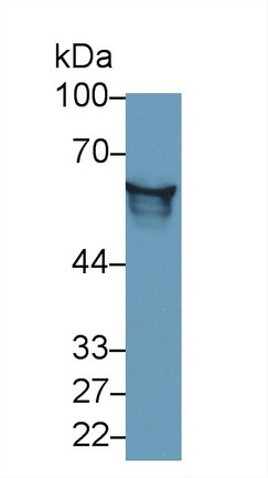 Monoclonal Antibody to Angiotensinogen (AGT)