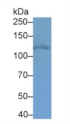 Monoclonal Antibody to Hypoxia Inducible Factor 1 Alpha (HIF1a)