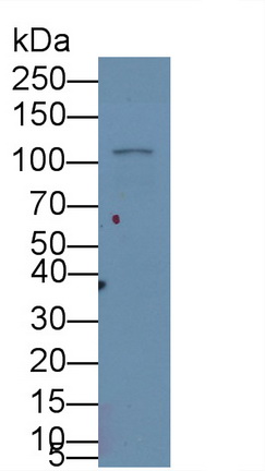 Monoclonal Antibody to Hypoxia Inducible Factor 1 Alpha (HIF1a)