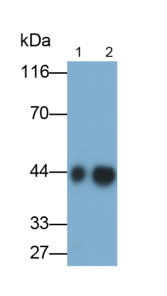 Monoclonal Antibody to Alpha-1-Acid Glycoprotein (a1AGP)