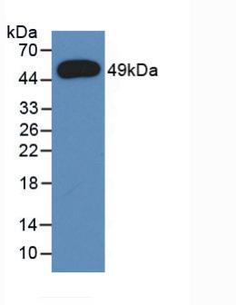 Monoclonal Antibody to Alpha-1-Acid Glycoprotein (a1AGP)