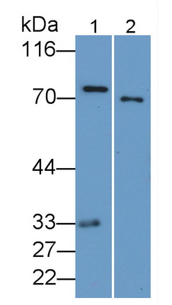 Monoclonal Antibody to Coagulation Factor II (F2)