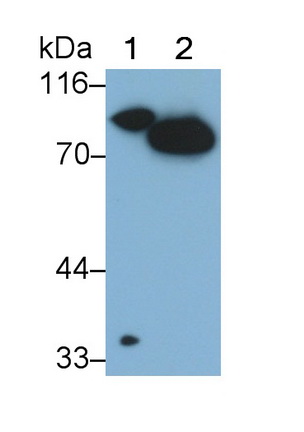 Monoclonal Antibody to Coagulation Factor II (F2)