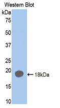 Monoclonal Antibody to Coagulation Factor II (F2)