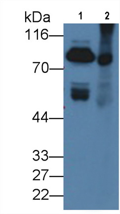 Monoclonal Antibody to Coagulation Factor II (F2)