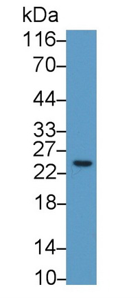 Monoclonal Antibody to C Reactive Protein (CRP)