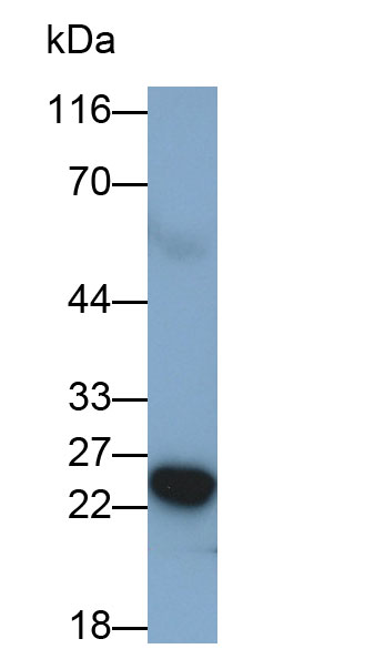 Monoclonal Antibody to C Reactive Protein (CRP)