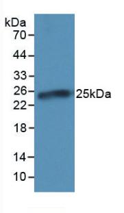 Monoclonal Antibody to C Reactive Protein (CRP)