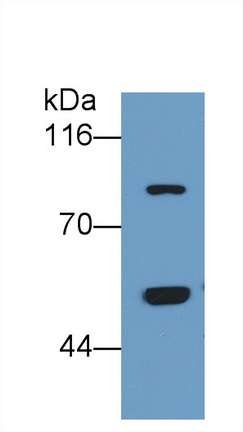 Monoclonal Antibody to Thrombin/Antithrombin Complex (TAT)