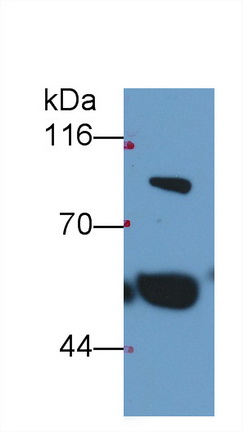 Monoclonal Antibody to Thrombin/Antithrombin Complex (TAT)