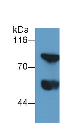 Monoclonal Antibody to Thrombin/Antithrombin Complex (TAT)