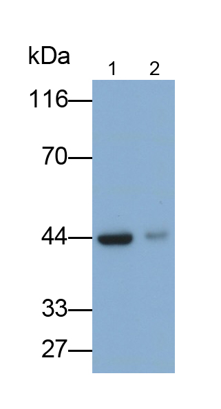 Monoclonal Antibody to Von Willebrand Factor (vWF)