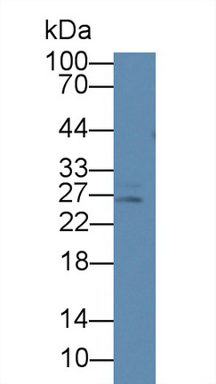 Monoclonal Antibody to Prolactin (PRL)