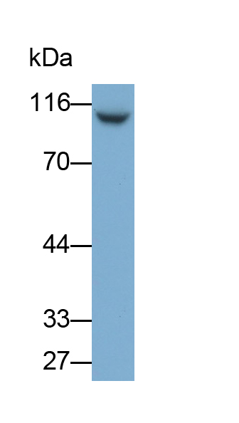 Monoclonal Antibody to Glycogen Phosphorylase, Liver (PYGL)