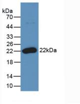 Monoclonal Antibody to Receptor Activator Of Nuclear Factor Kappa B Ligand (RANkL)