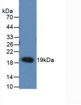 Monoclonal Antibody to Receptor Activator Of Nuclear Factor Kappa B Ligand (RANkL)