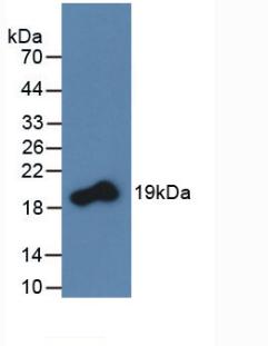 Monoclonal Antibody to Receptor Activator Of Nuclear Factor Kappa B Ligand (RANkL)