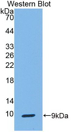 Monoclonal Antibody to Clara Cell Protein 16 (CC16)