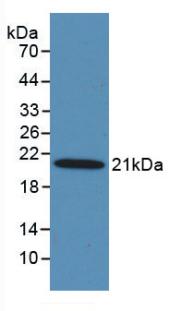 Monoclonal Antibody to Mannose Associated Serine Protease 2 (MASP2)