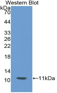 Monoclonal Antibody to Parathyroid Hormone (PTH)