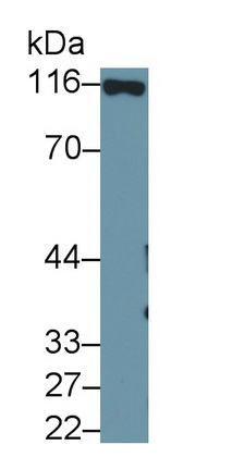 Monoclonal Antibody to Cluster Of Differentiation 26 (CD26)