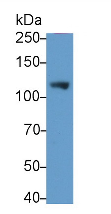 Monoclonal Antibody to Cluster Of Differentiation 26 (CD26)