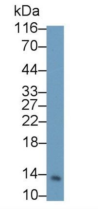 Monoclonal Antibody to Serum Amyloid A (SAA)