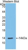 Monoclonal Antibody to Renin (REN)