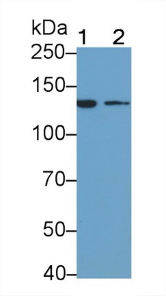 Monoclonal Antibody to Insulin Receptor (INSR)