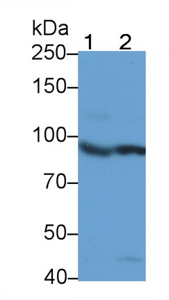 Monoclonal Antibody to Insulin Receptor (INSR)