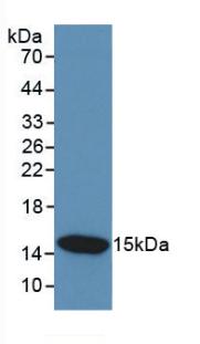 Monoclonal Antibody to Cystatin C (Cys-C)