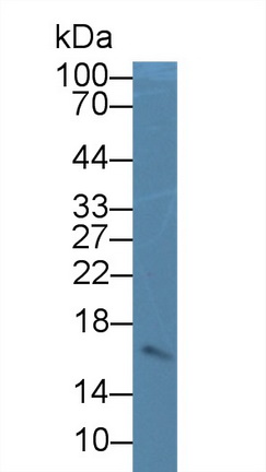 Monoclonal Antibody to Cystatin C (Cys-C)