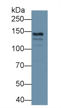 Monoclonal Antibody to Ceruloplasmin (CP)