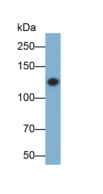 Monoclonal Antibody to Ceruloplasmin (CP)