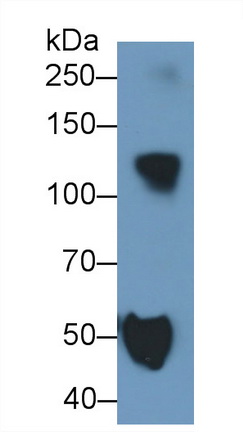 Monoclonal Antibody to Ceruloplasmin (CP)