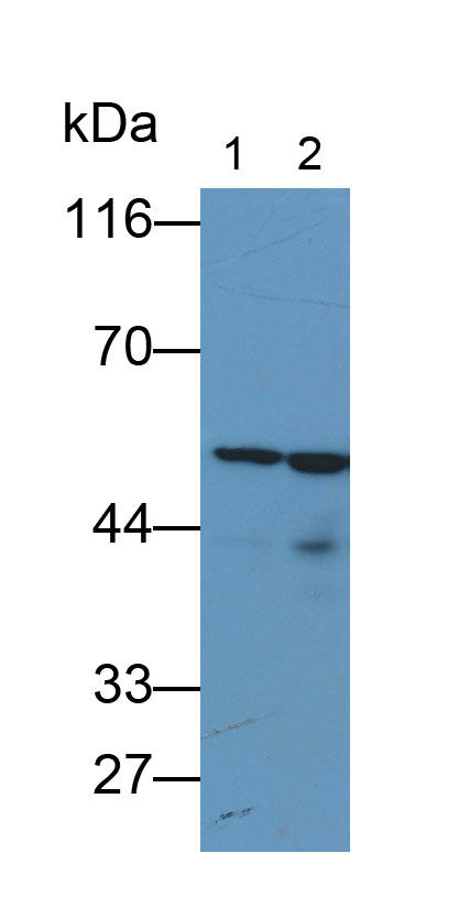 Monoclonal Antibody to Tumor Protein p53 (P53)