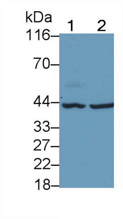 Monoclonal Antibody to Tumor Protein p53 (P53)