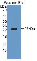 Monoclonal Antibody to Retinol Binding Protein 4 (RBP4)