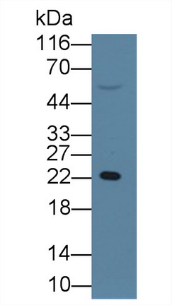 Monoclonal Antibody to Retinol Binding Protein 4 (RBP4)