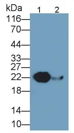 Monoclonal Antibody to Retinol Binding Protein 4 (RBP4)