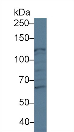 Monoclonal Antibody to Amyloid Beta Peptide 1-42 (Ab1-42)