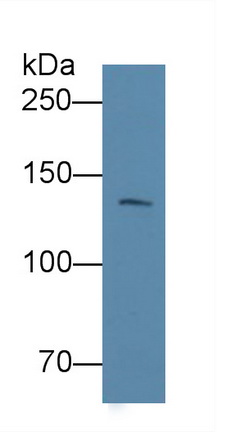 Monoclonal Antibody to Procollagen I N-Terminal Propeptide (PINP)