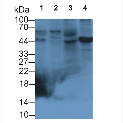 Monoclonal Antibody to Glypican 3 (GPC3)