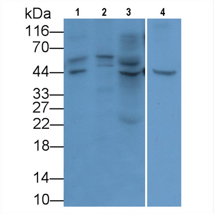 Monoclonal Antibody to Glypican 3 (GPC3)